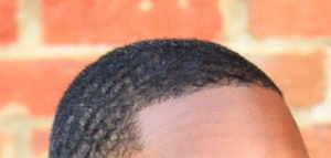 Straight hairline on black 4C hair.